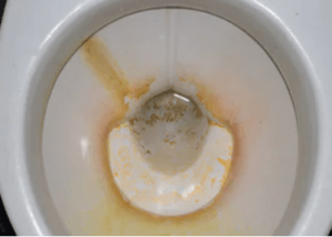 How to Remove Hard Water Stains in a Toilet